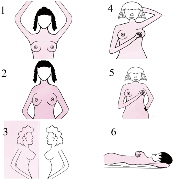Breast Self-Exam