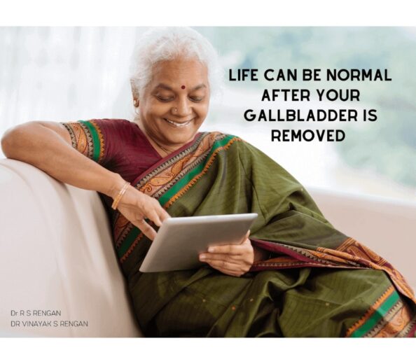 life expectancy after gallbladder removal