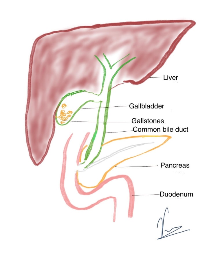 gallbladder drawing