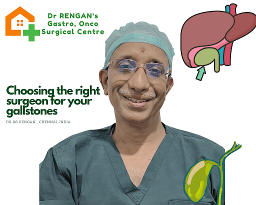 Best Gallstone Surgeon in chennai