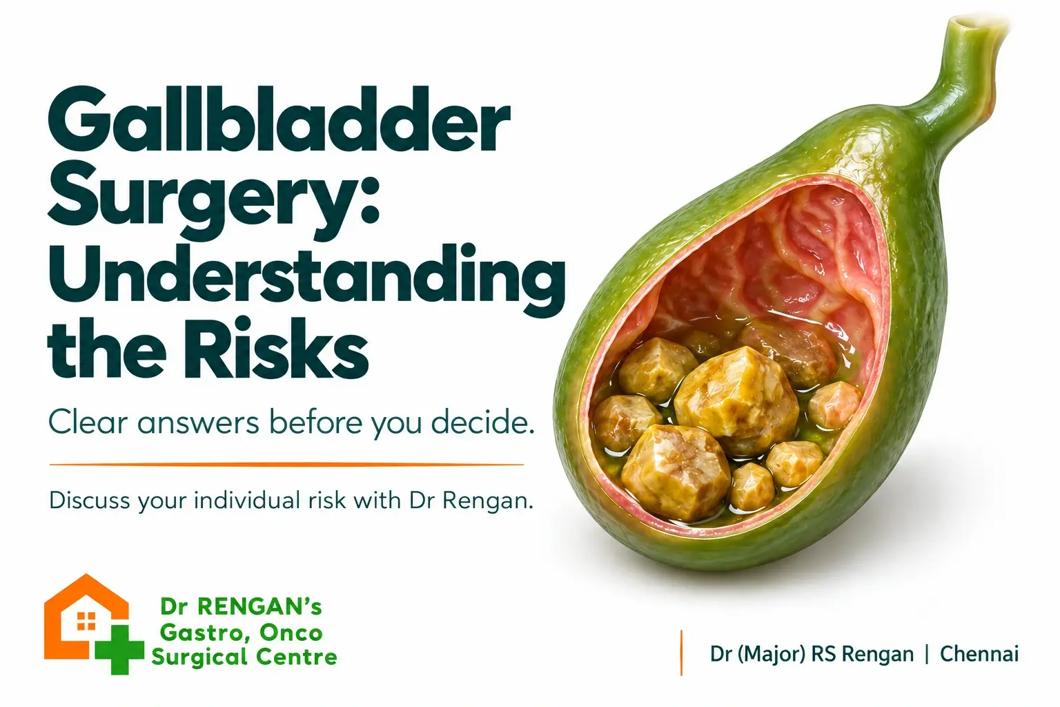 Gallbladder surgery risks and gallstones with Dr Rengan in Chennai